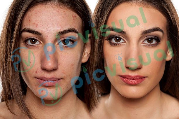 Professional Portrait Retouching Services