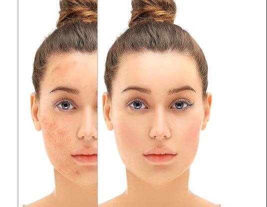 Skin Retouching Services