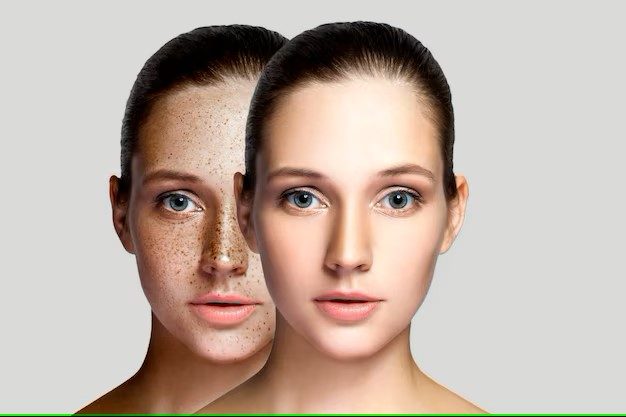Skin Retouching Services